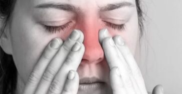 Acute Sinusitis Treatment