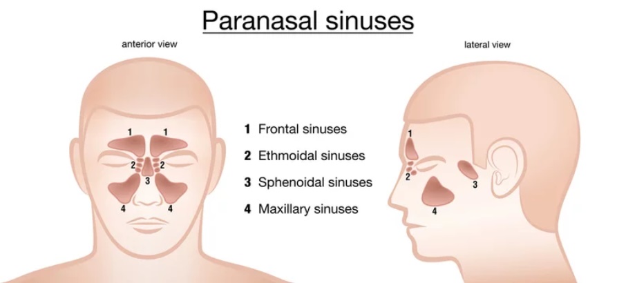 Acute Sinusitis